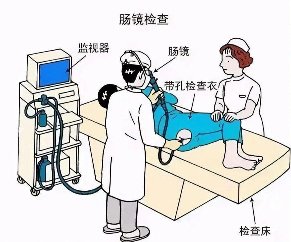 结肠镜检查