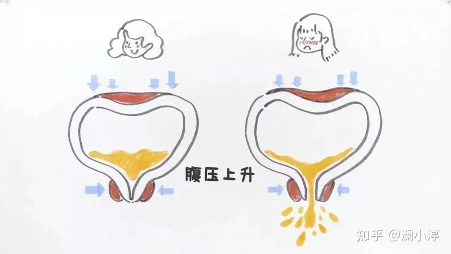 腹压升高