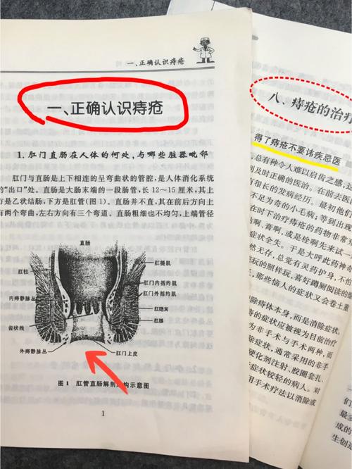 痔疮消失方法