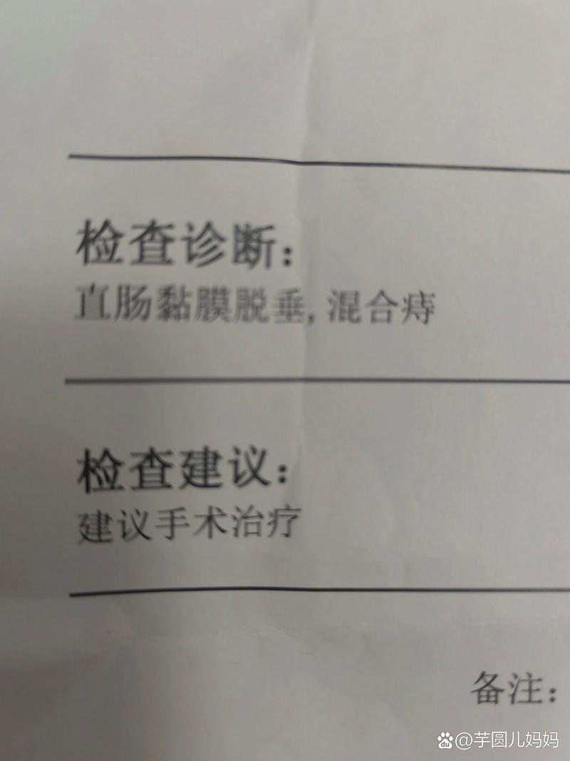 西医诊断痔疮