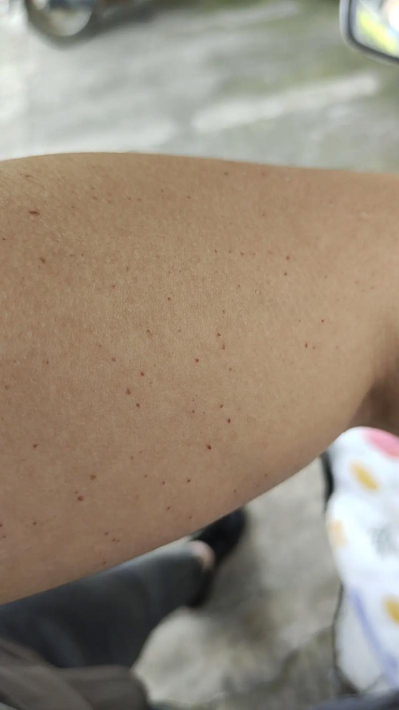 红点
