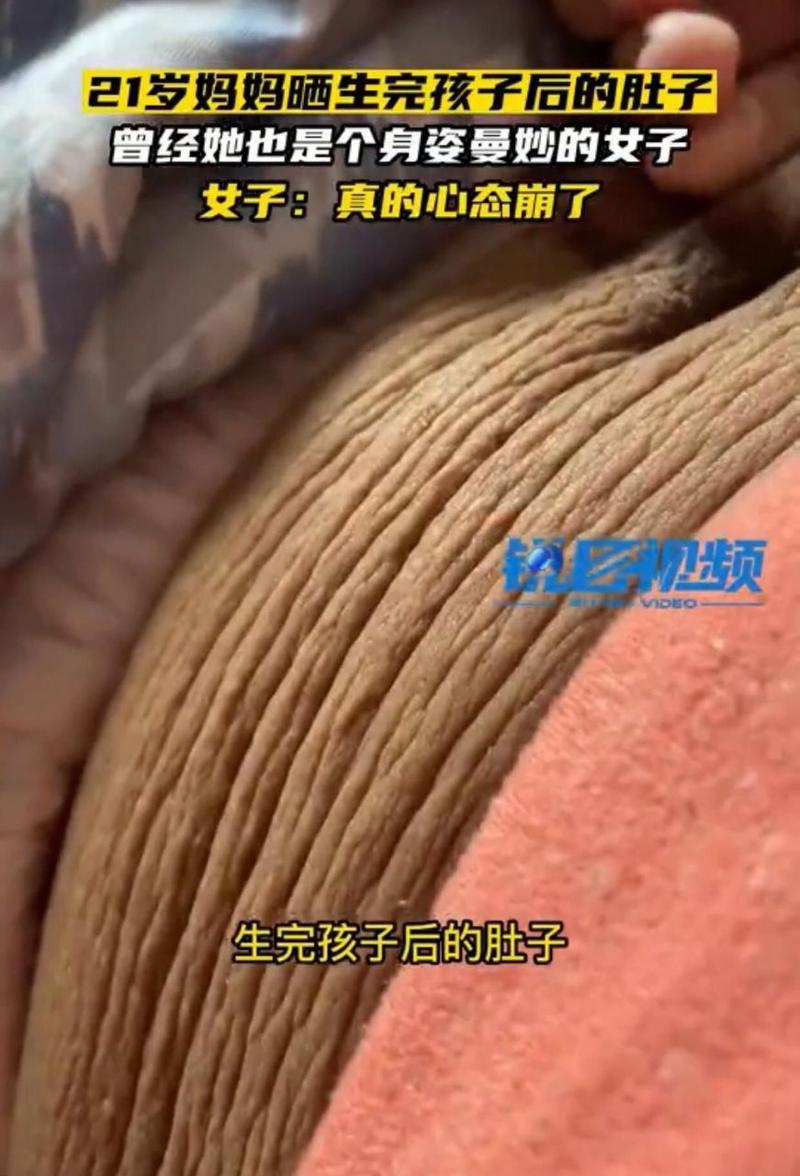  生产后