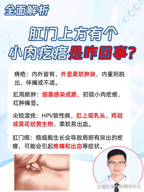 痔疮肉揪