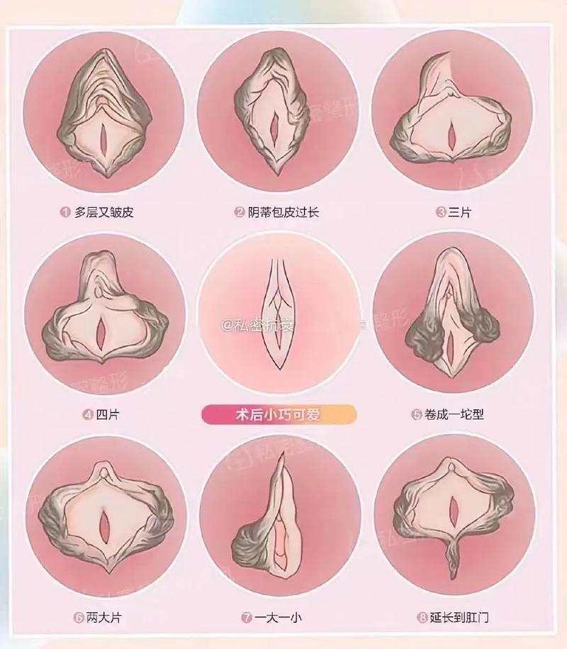 私密