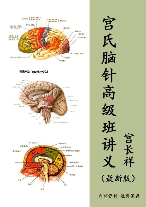 宫氏脑针