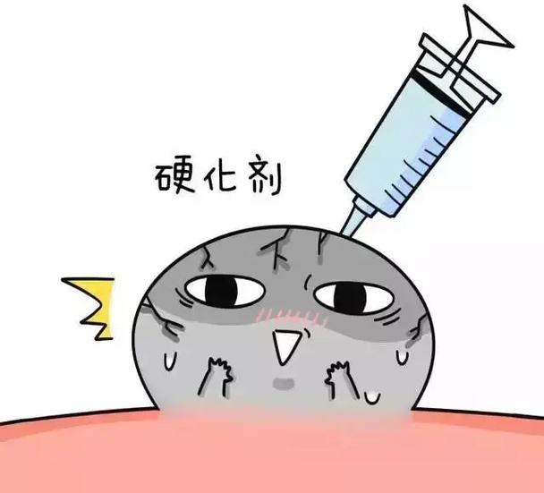  硬化剂注射