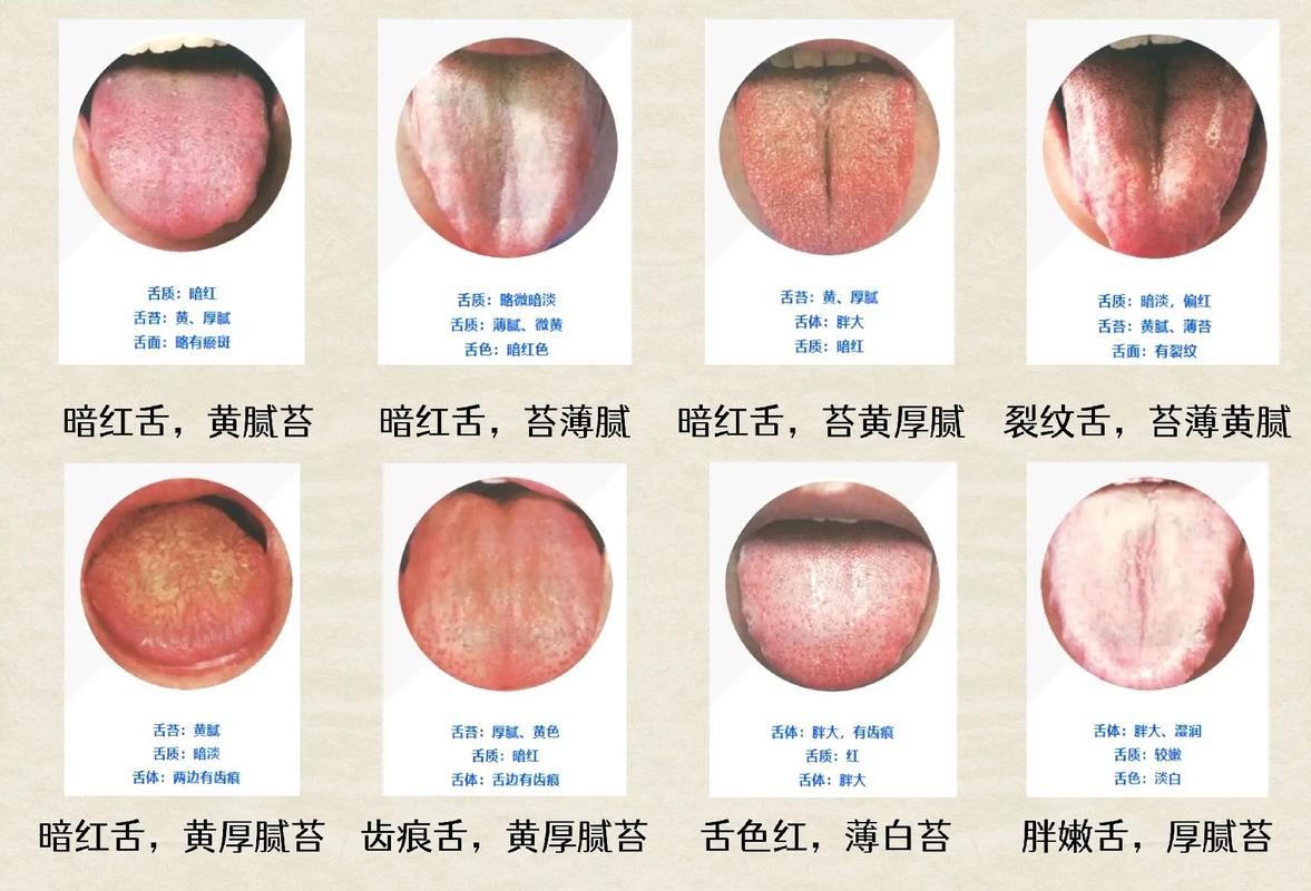 舌象