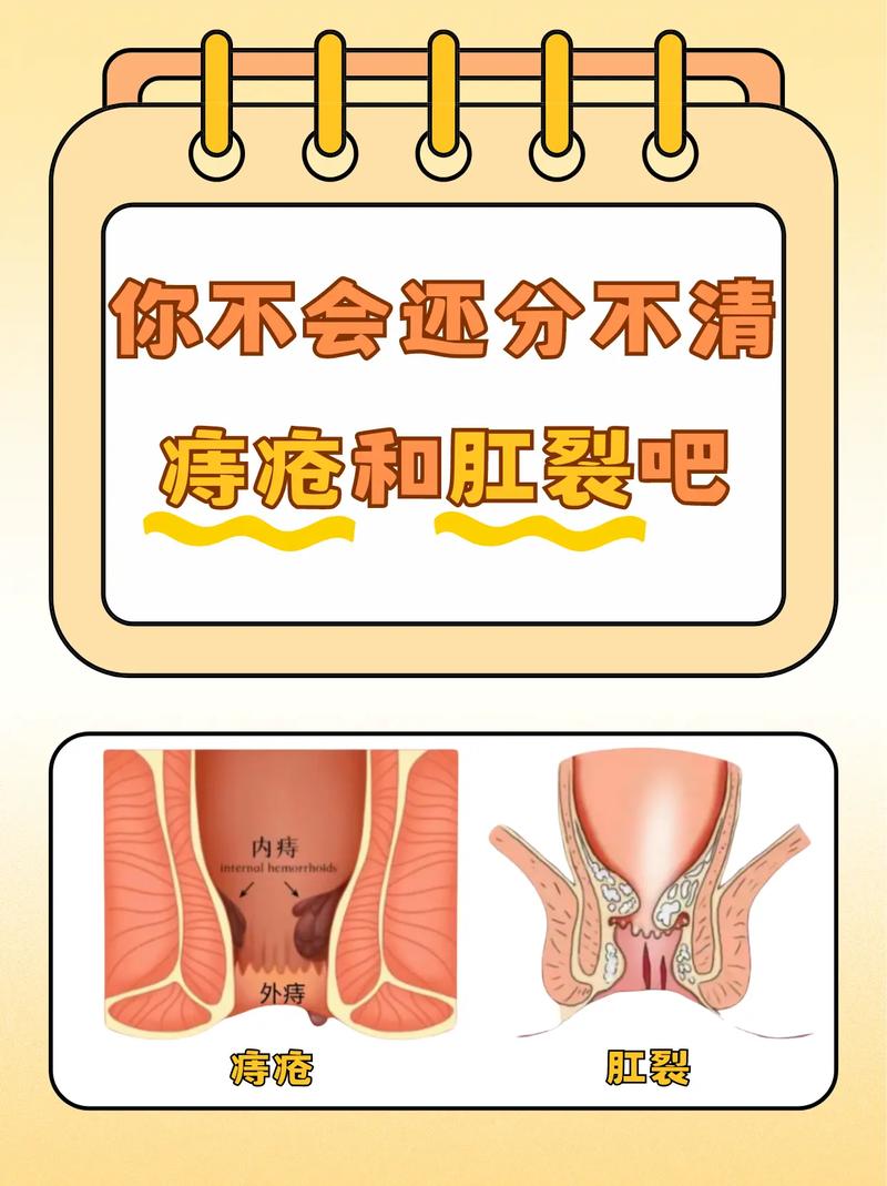 痔疮肛裂