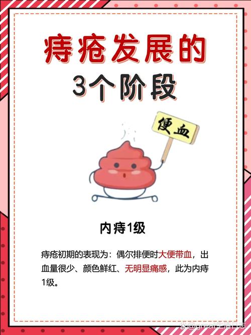 痔疮严重程度