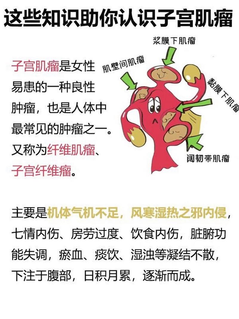 子宫压迫