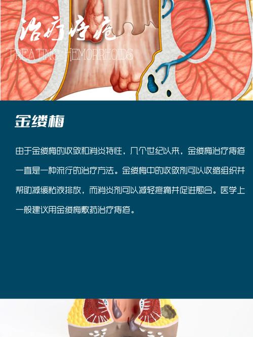 百度痔疮疗法