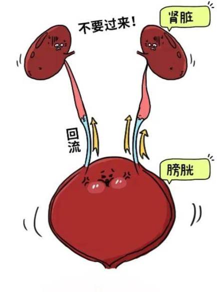 尿潴留