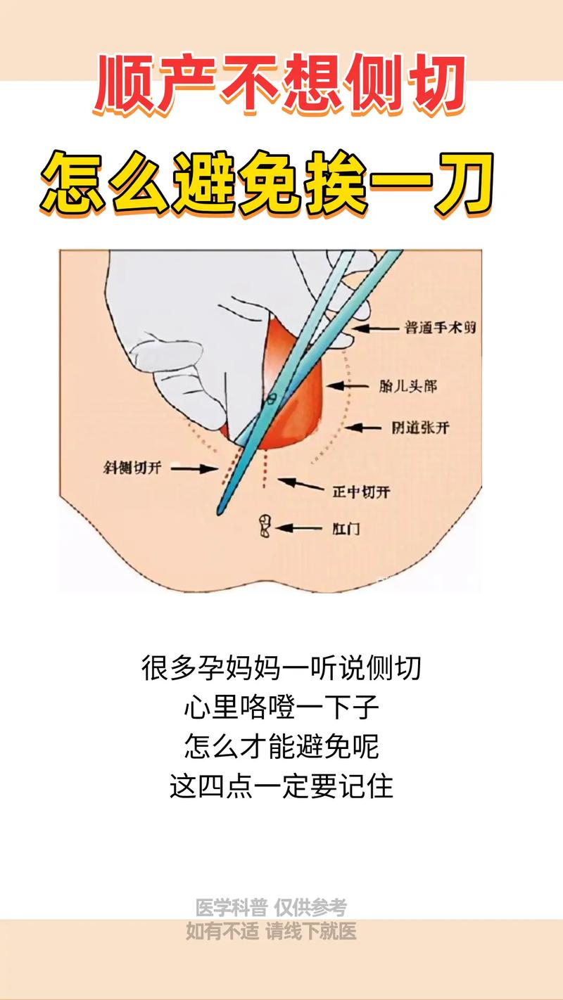 侧切
