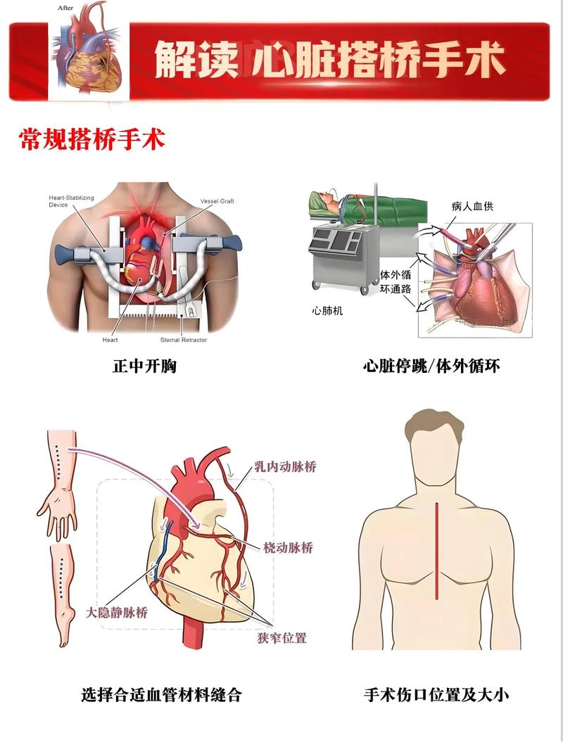  治疗方式