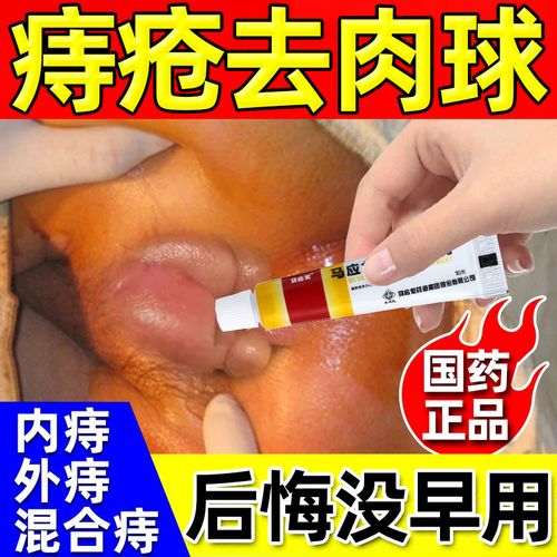 混合型痔疮，药物，疗效