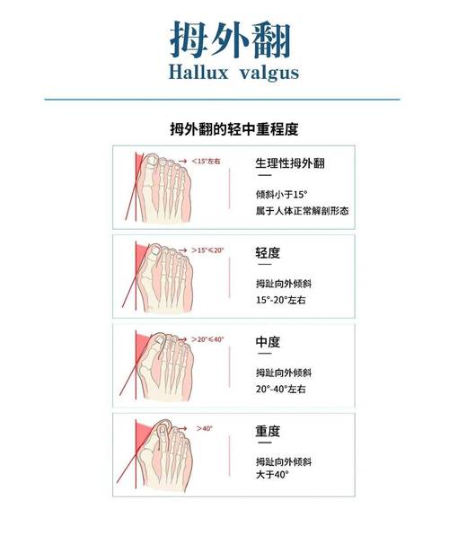治疗方法差异