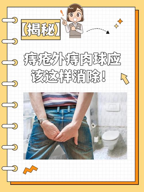 外痔肉球消除