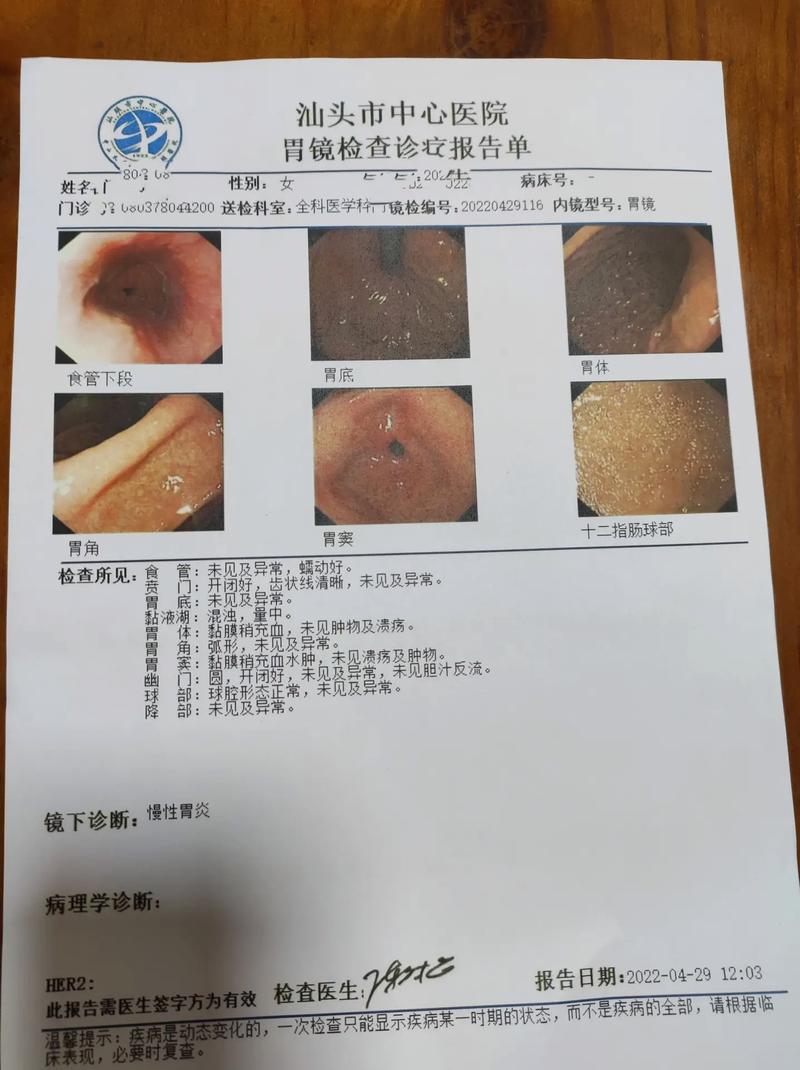胃炎