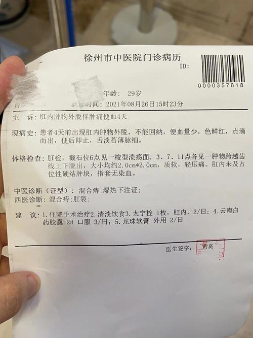 中医诊断痔疮