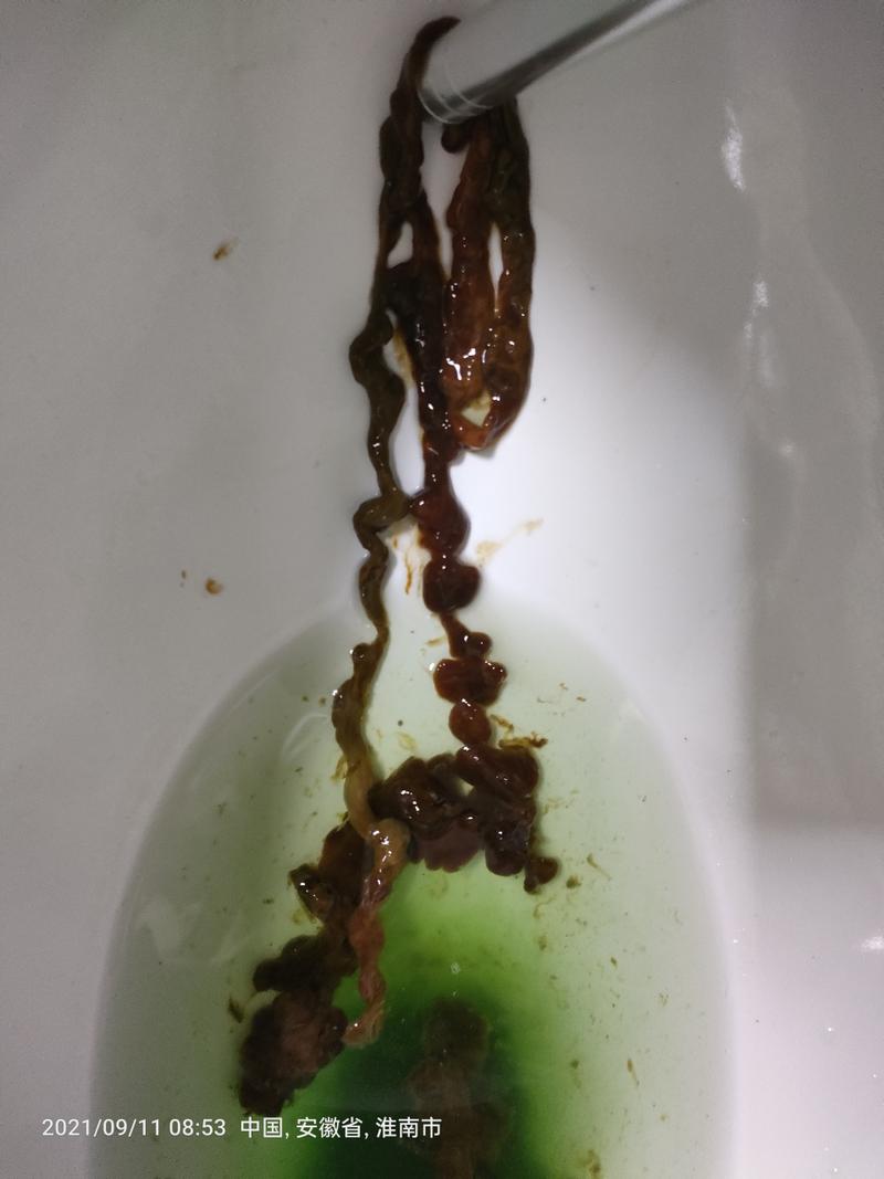 排便异物感