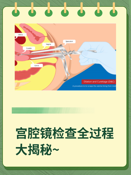  检查过程