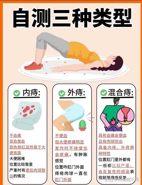 产后痔疮痒
