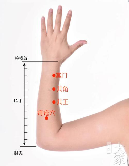 刮痧治疗痔疮