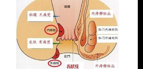 痔疮位置