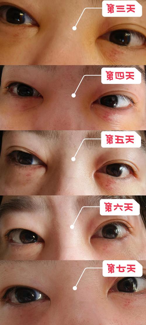 恢复情况