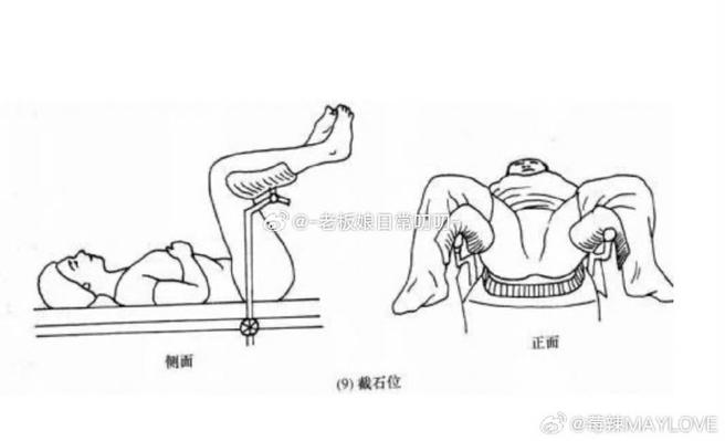 检查姿势