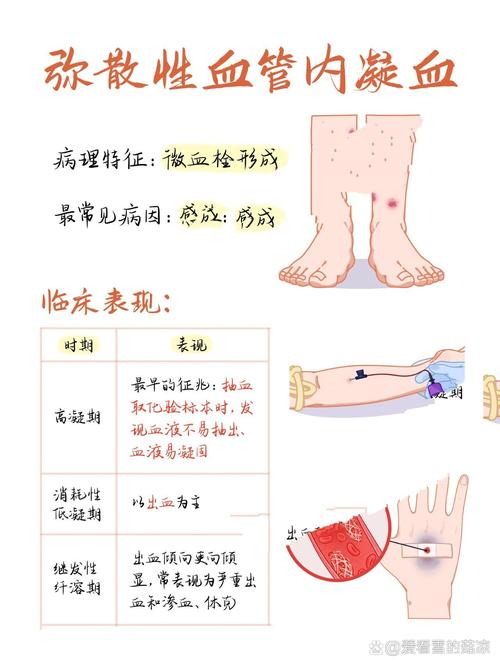 凝血功能障碍