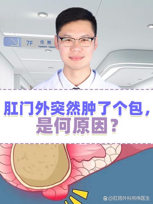 痔疮肿大