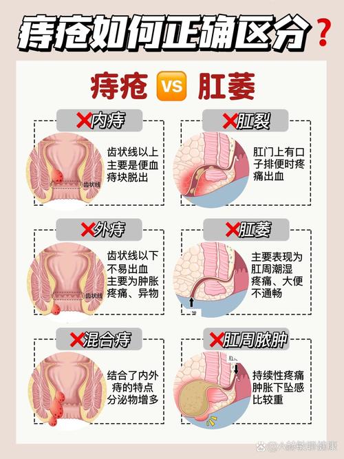 肉球收缩