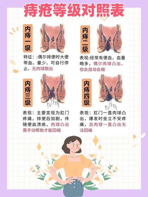 痔疮几率