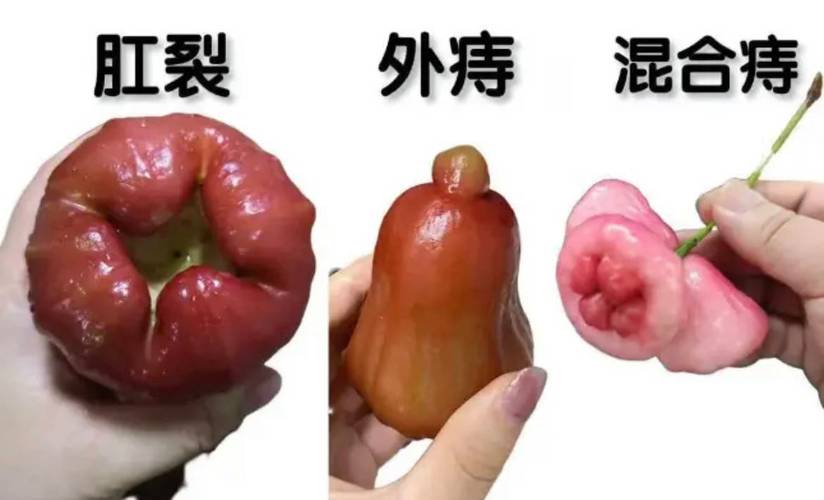 新田痔疮治疗中心