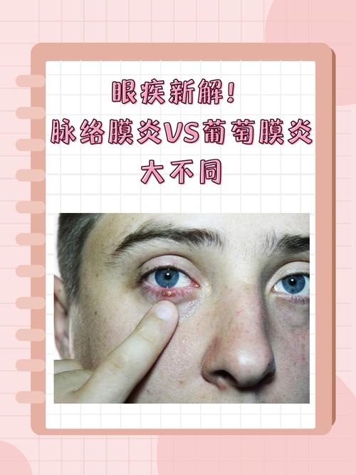 眼疾