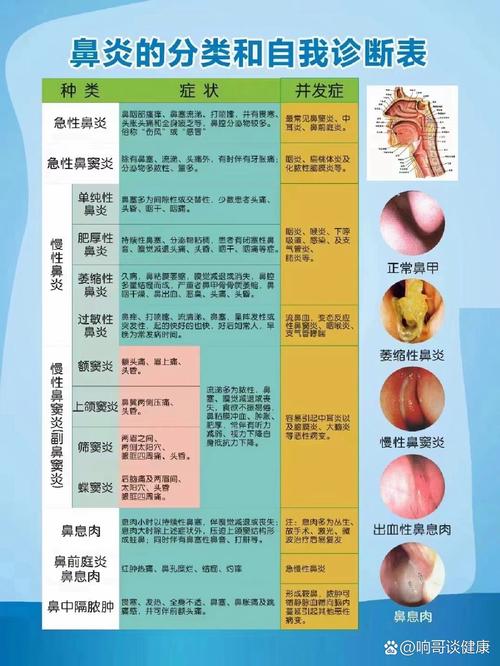 鼻炎症状