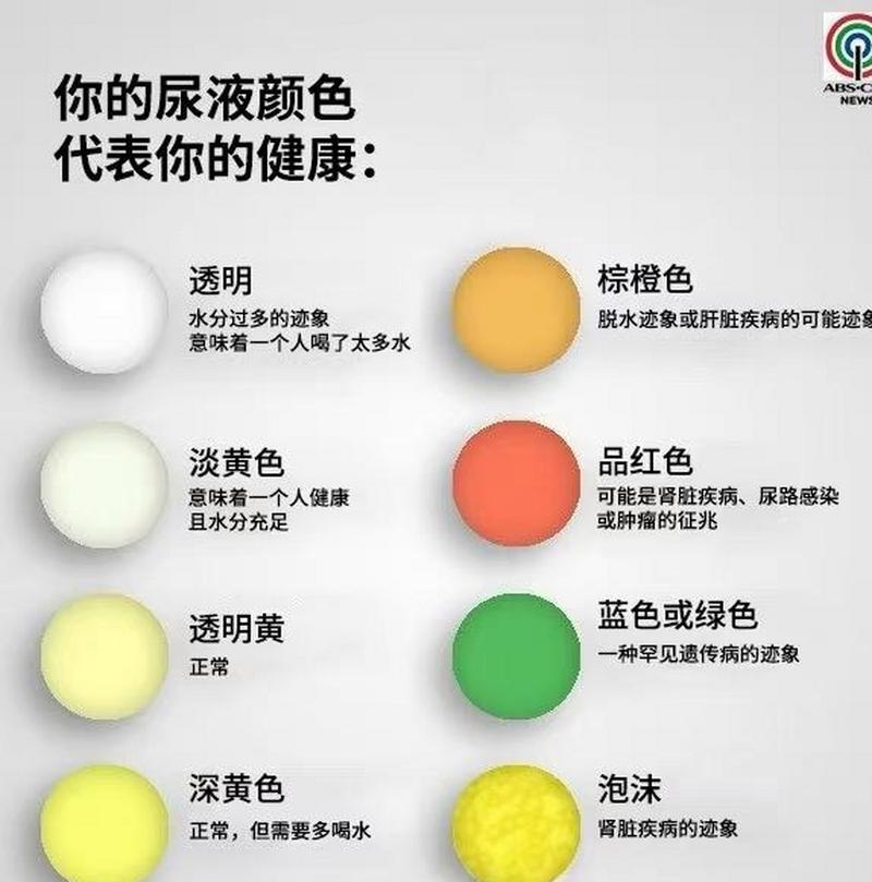 尿液颜色