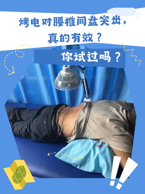 烤电治疗