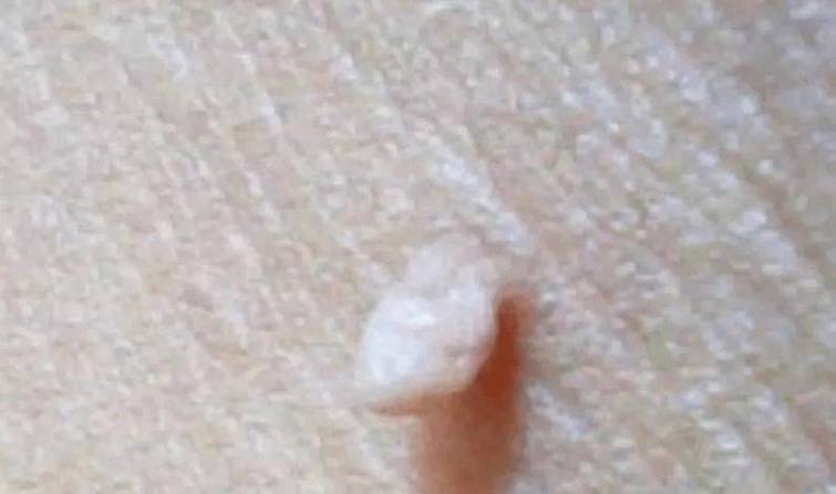 肉粒