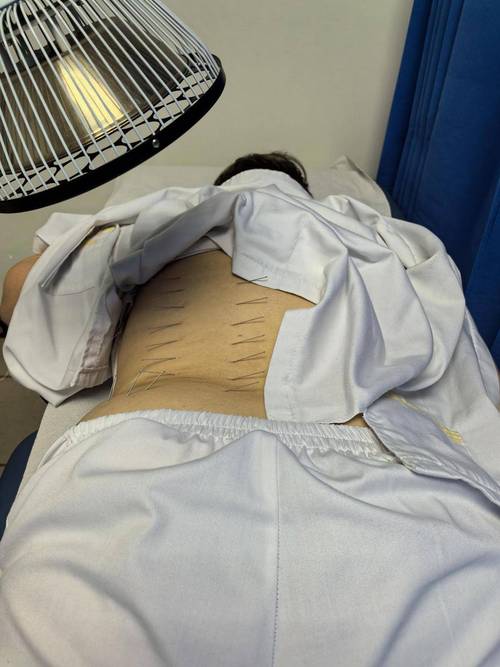 腰背部打针