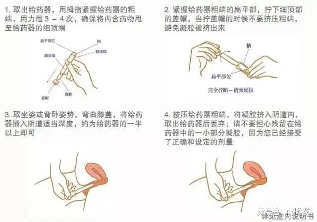 塞药技巧