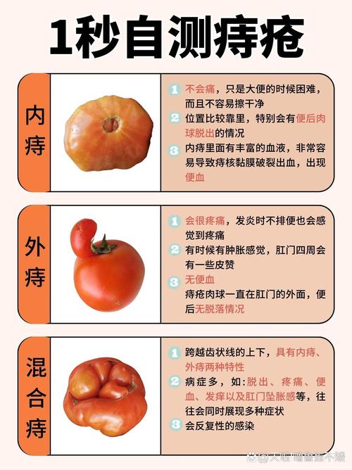 长痔疮