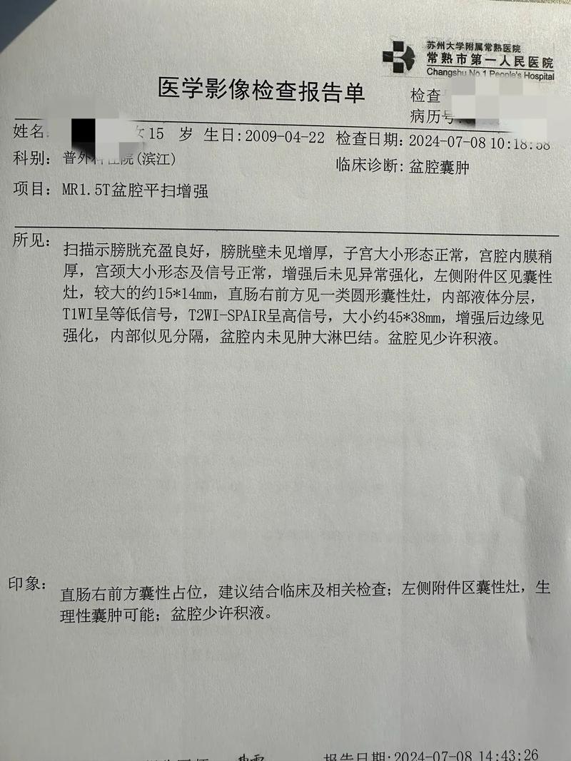 罕见病例