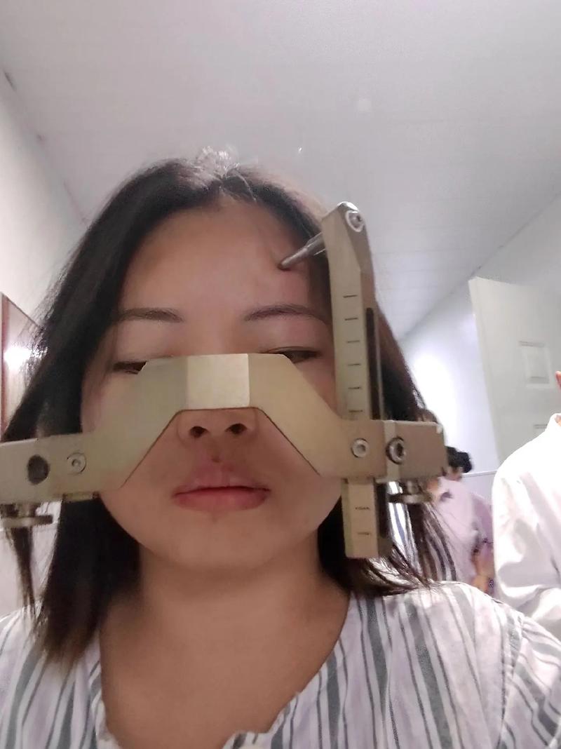 术前恐惧