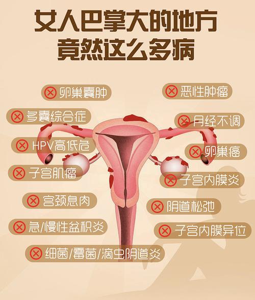 妇科疾病