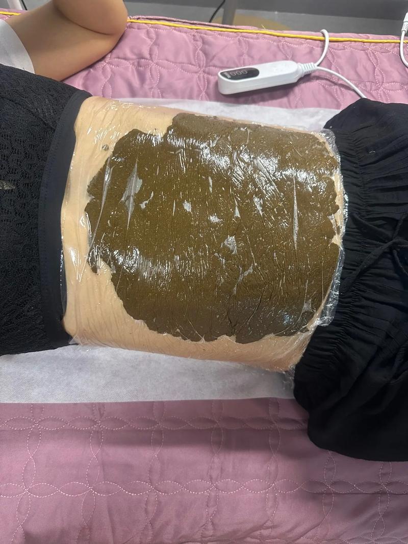 中药外敷疗法
