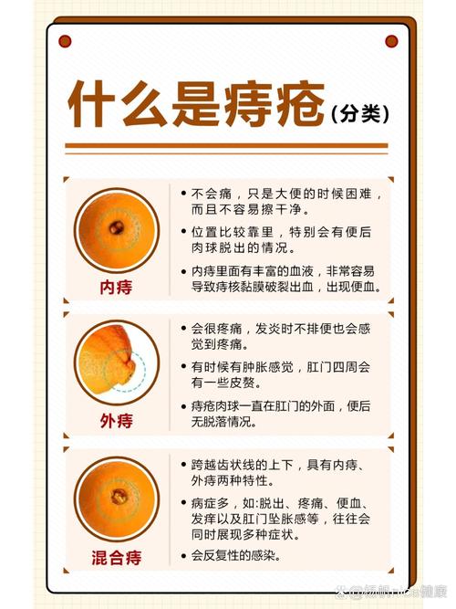 痔疮核
