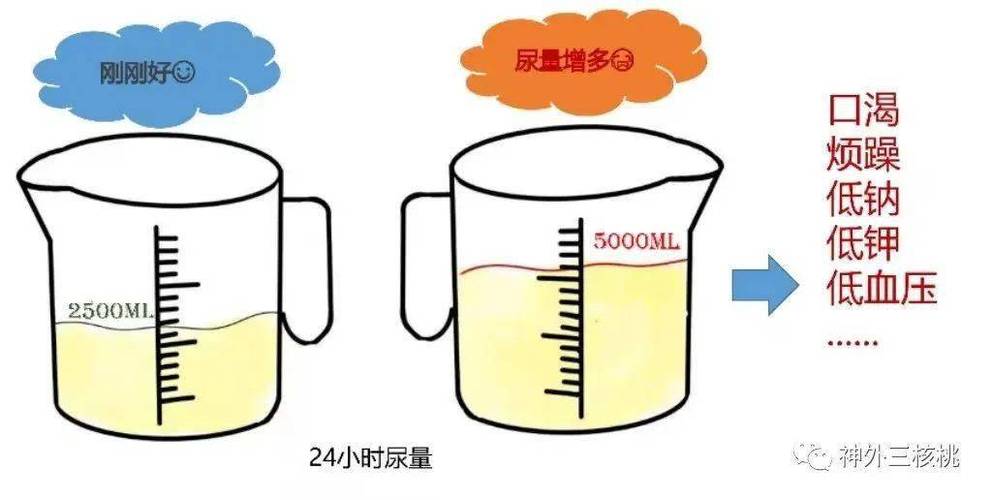 尿量变化