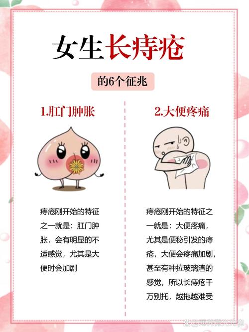 女性痔疮疼